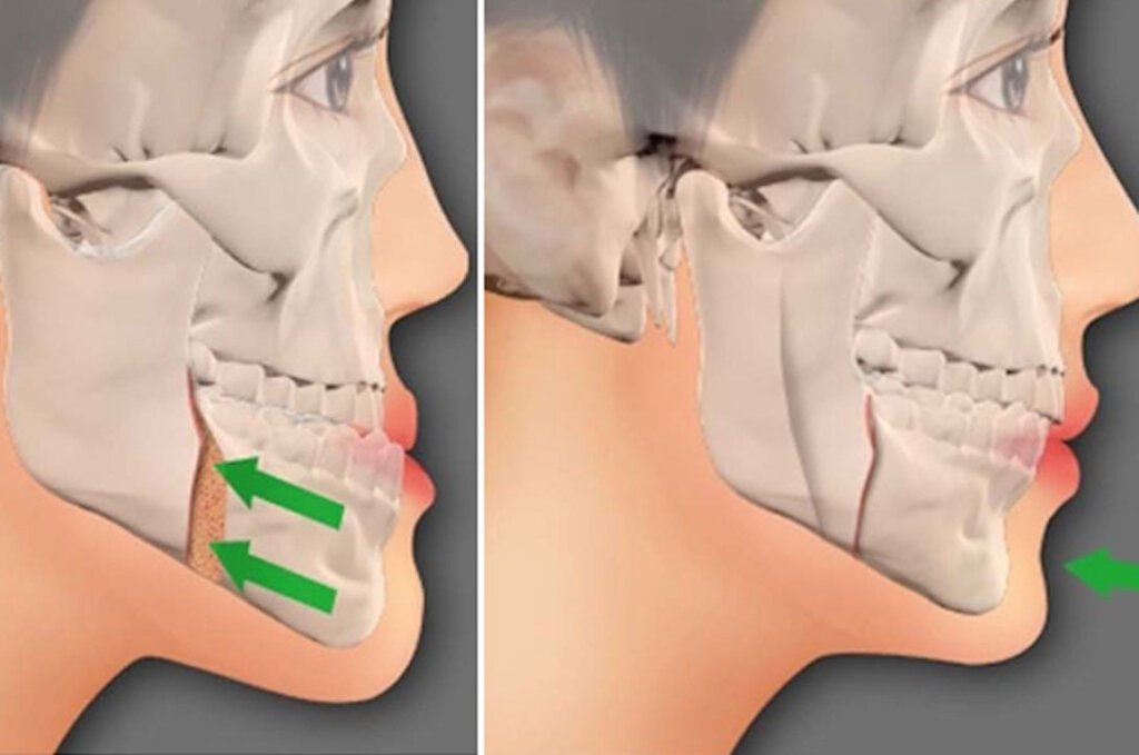 Facilities Best Dentist In Hyderabad